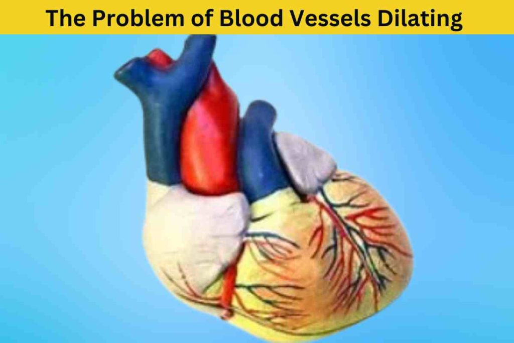 The Problem of Blood Vessels Dilating in Compensation for Trauma: A Brief Overview